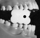 Bitekloss - til bruk i Myofunksjonell beh. (10 pk) thumbnail